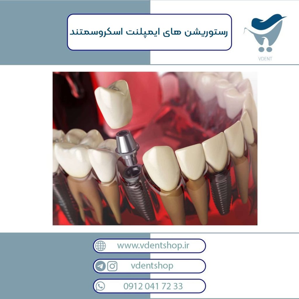 رستوریشن های ایمپلنتی اسکروسمنتد