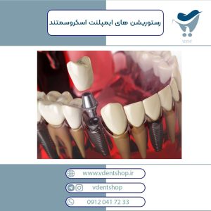 رستوریشن های ایمپلنتی اسکروسمنتد