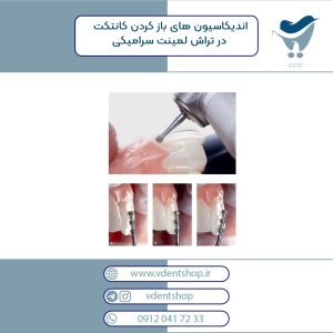 اندیکاسیون های باز کردن کانتکت در تراش لمینت سرامیکی