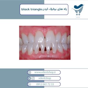 راه های برطرف کردن black triangle