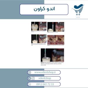 اندو کراون