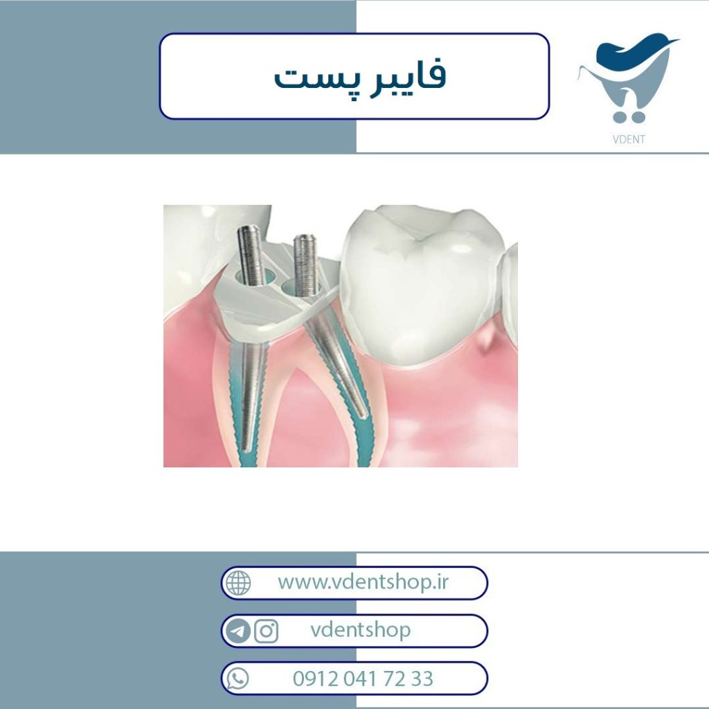 فایبرپست