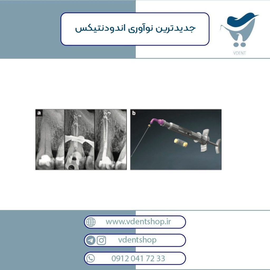 جدید ترین نوآوری های اندودنتیکس