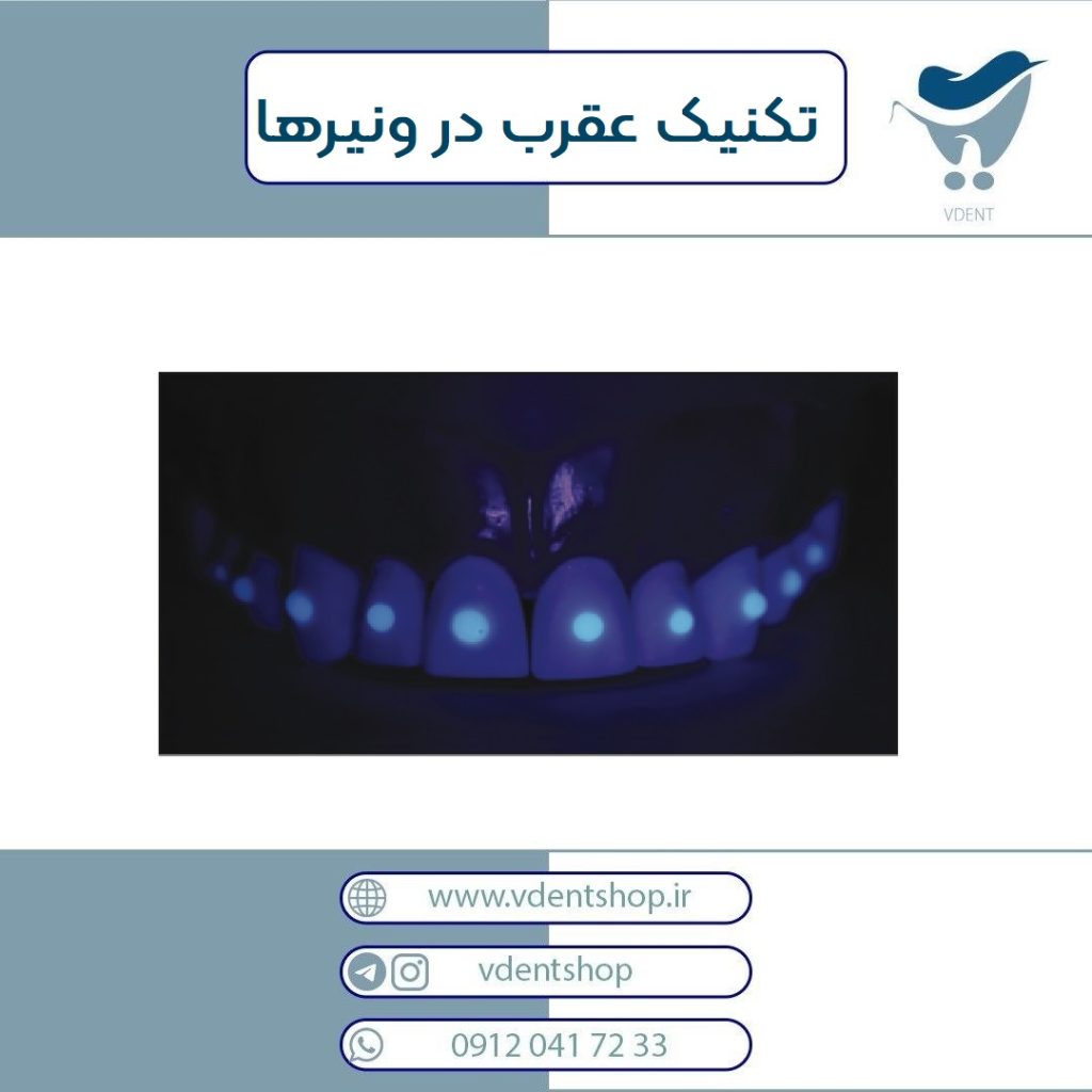 تکنیک عقرب در ونیرها