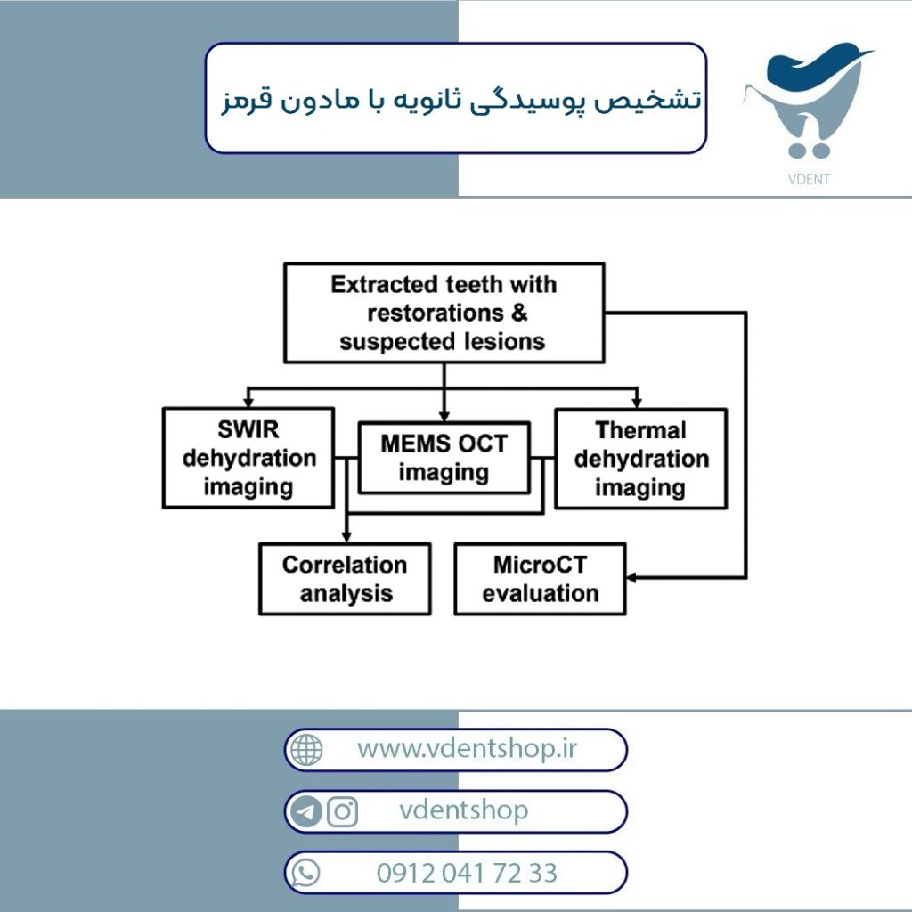 تشخیص پوسیدگی ثانویه به وسیله ی مادون قرمز